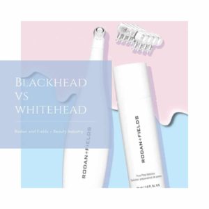 Blackhead vs Whitehead + Blackhead Treatment