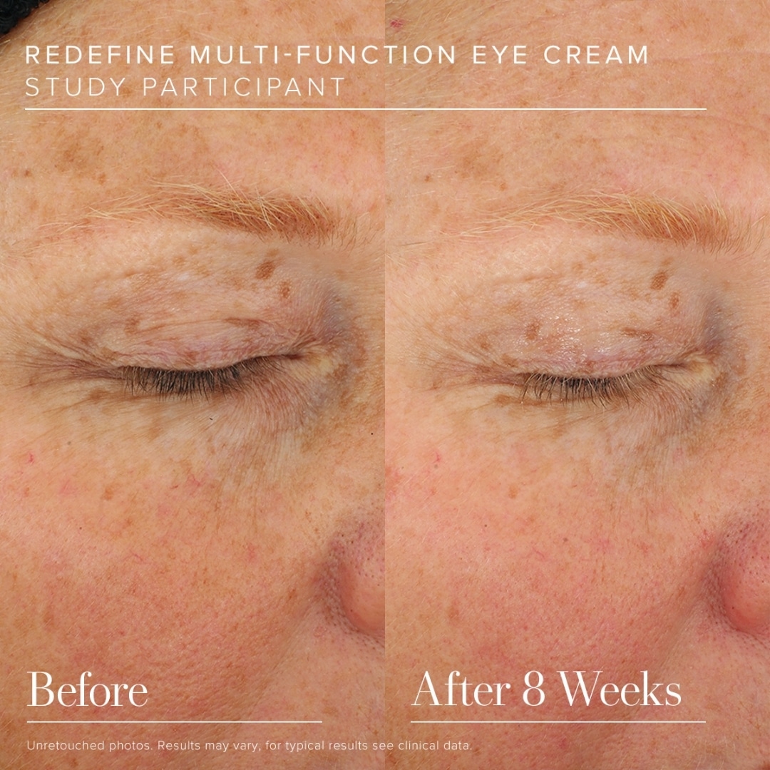 Before & After Eye Cream